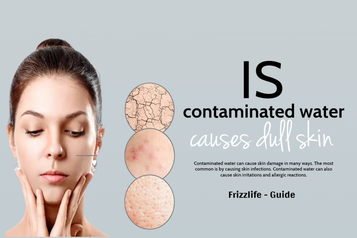 Is contaminated water causes dull skin