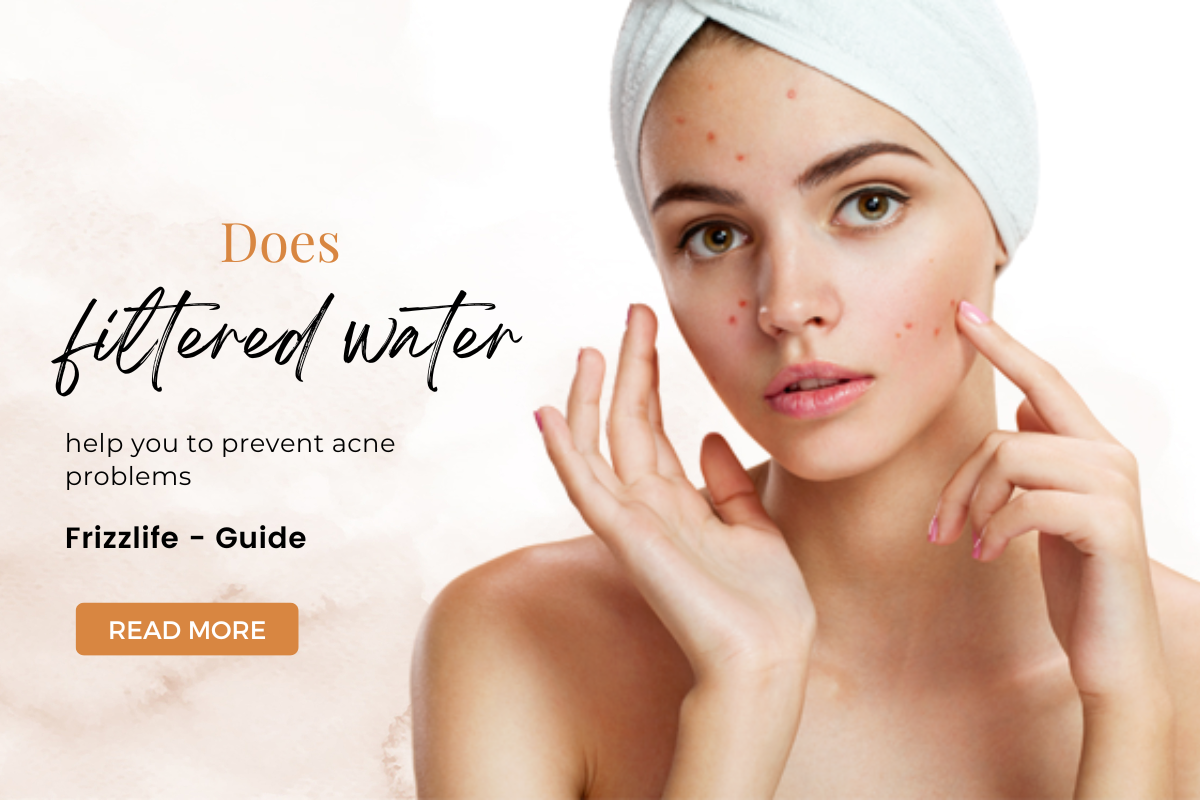 Filtered water and skin acne